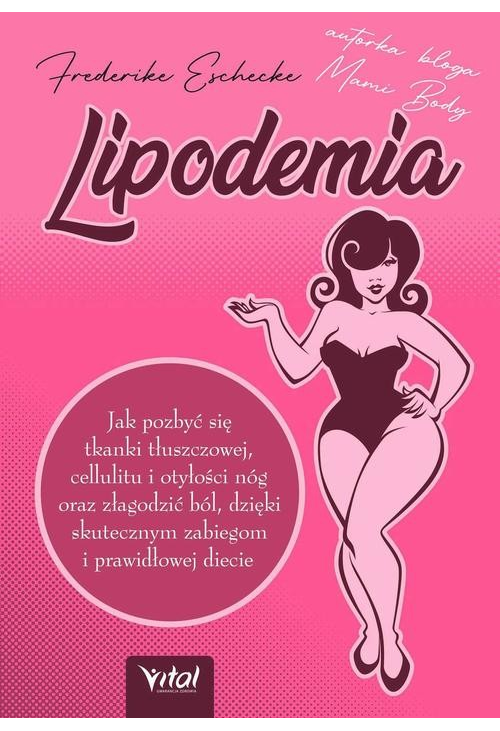 Lipodemia