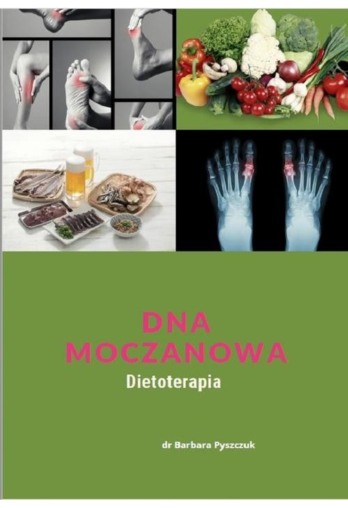 Dna Moczanowa Dietoterapia