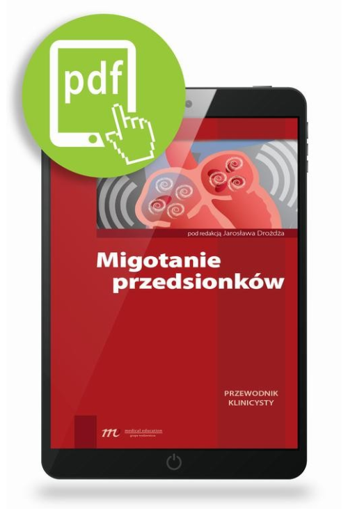 Migotanie przedsionków