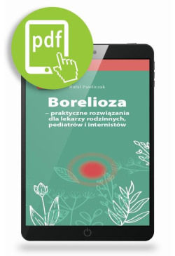 Borelioza - praktyczne...