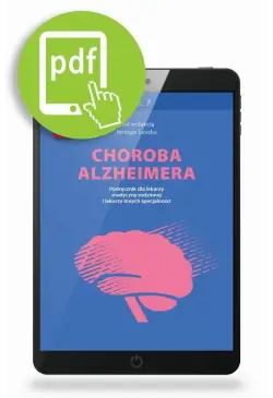 Choroba Alzheimera