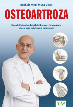 Osteoartroza. Usuń ból...