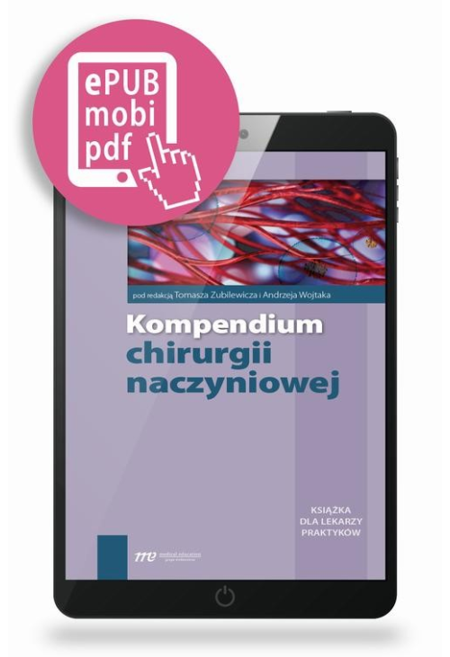 Kompendium chirurgii naczyniowej