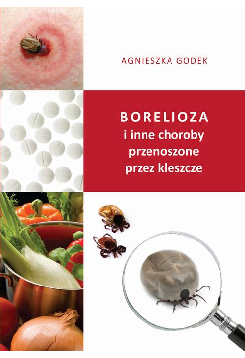 Borelioza i inne choroby przenoszone przez kleszcze