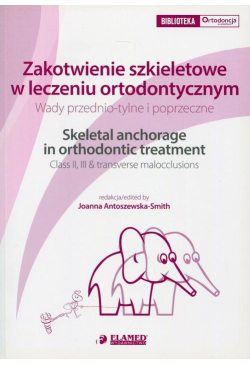 Zakotwienie szkieletowe w...