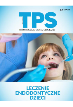 Leczenie endodontyczne dzieci