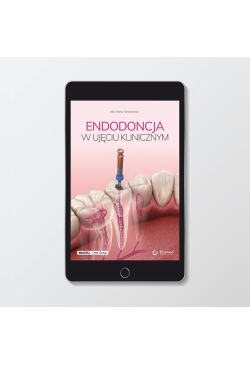 Endodoncja w ujęciu klinicznym