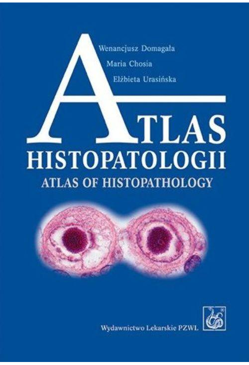 Atlas histopatologii.Tajemniczy świat chorych komórek człowieka