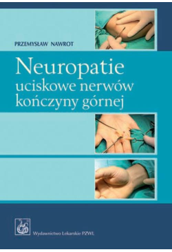 Neuropatie uciskowe nerwów...