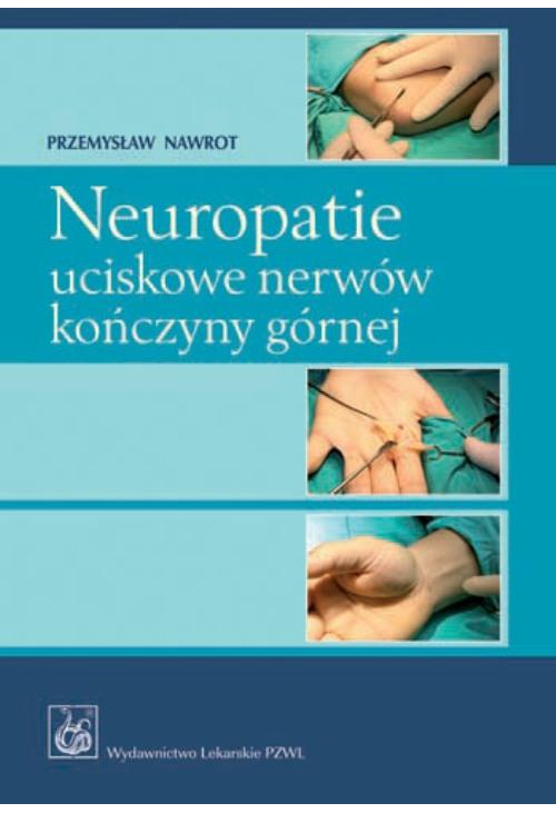 Neuropatie uciskowe nerwów kończyny górnej