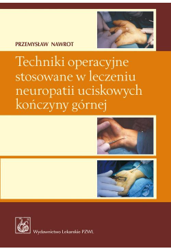 Techniki operacyjne...
