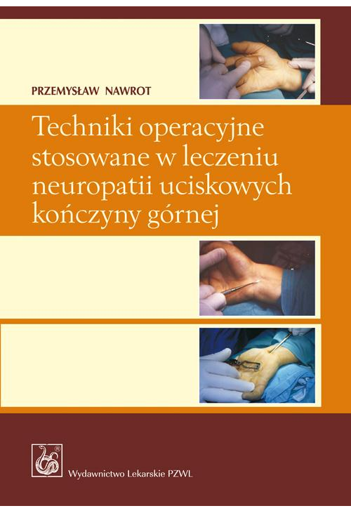 Techniki operacyjne stosowane w leczeniu neuropatii uciskowych kończyny górnej.