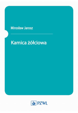 Kamica żółciowa