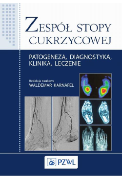 Zespół stopy cukrzycowej