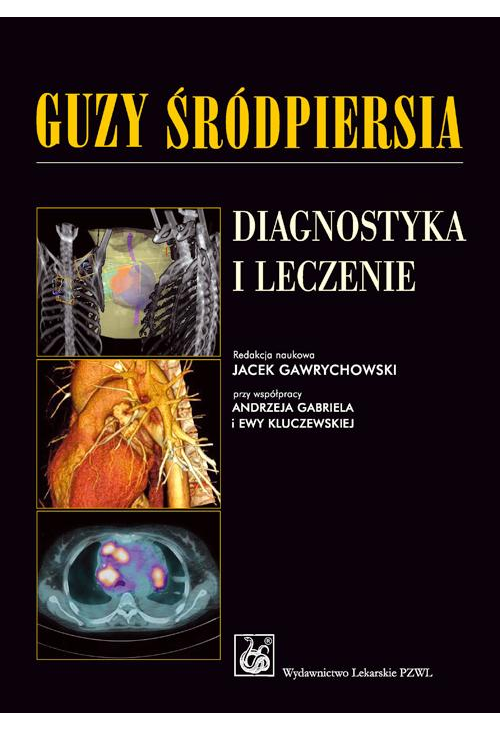 Guzy śródpiersia. Diagnostyka i leczenie