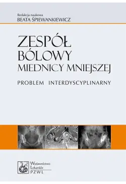 Zespół bólowy miednicy...