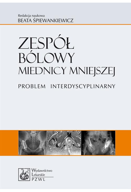 Zespół bólowy miednicy mniejszej. Problem interdyscyplinarny