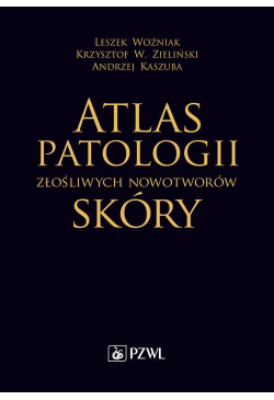 Atlas patologii złośliwych...