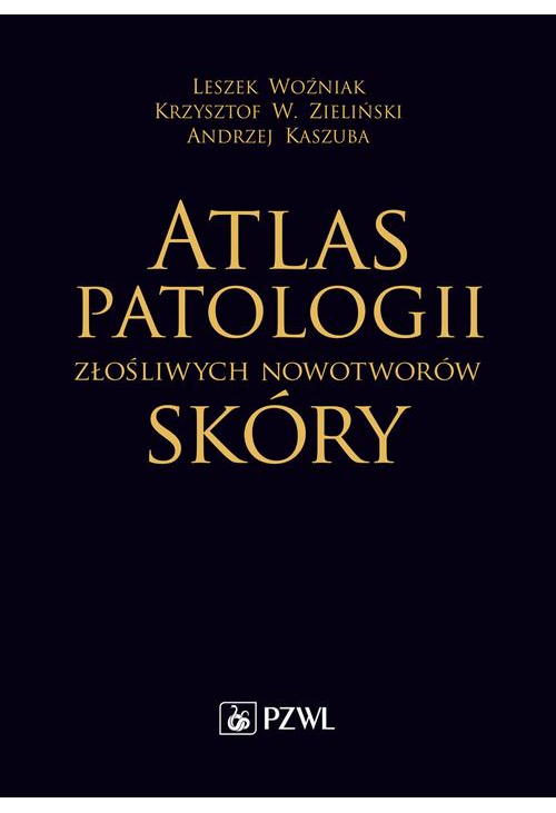 Atlas patologii złośliwych nowotworów skóry