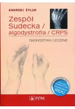 Zespół Sudecka /...