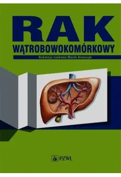 Rak wątrobowokomórkowy