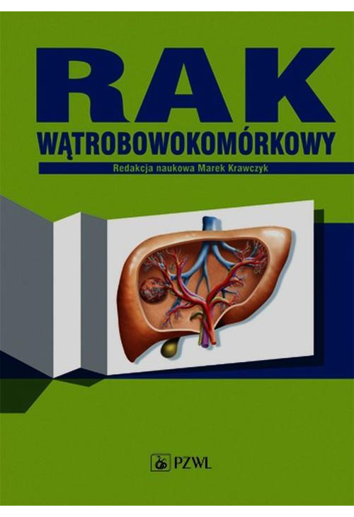 Rak wątrobowokomórkowy