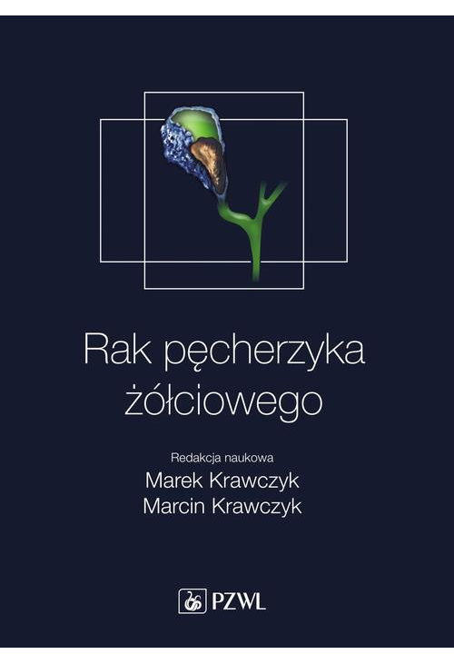 Rak pęcherzyka żółciowego