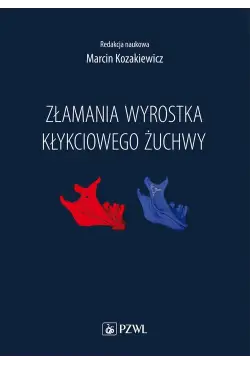 Złamania wyrostka...