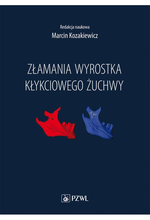 Złamania wyrostka kłykciowego żuchwy