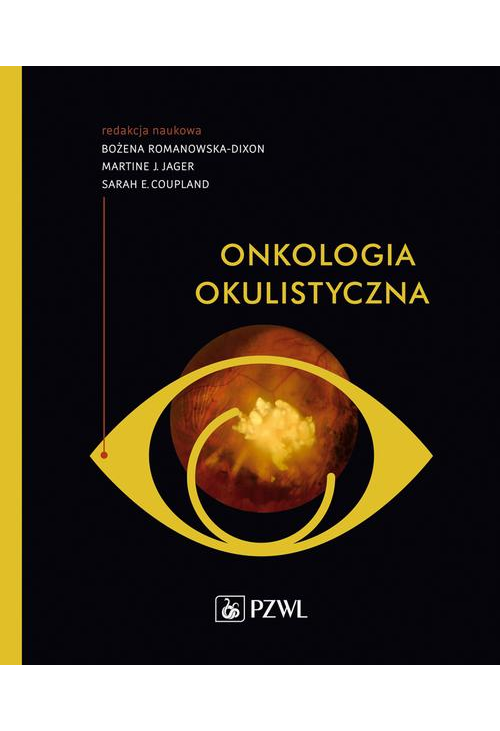 Onkologia okulistyczna