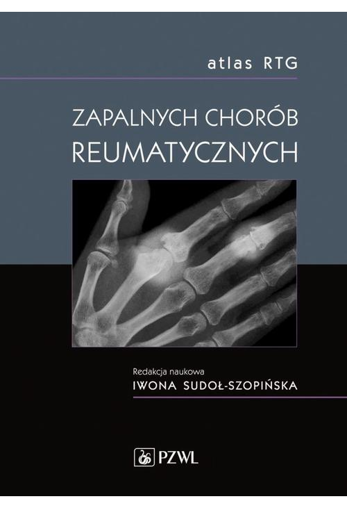 Atlas RTG zapalnych chorób reumatycznych