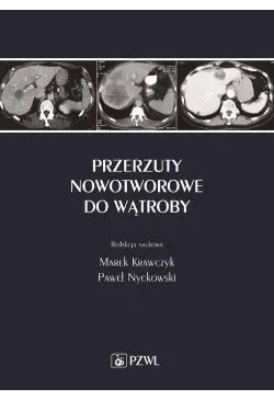 Przerzuty nowotworowe do...