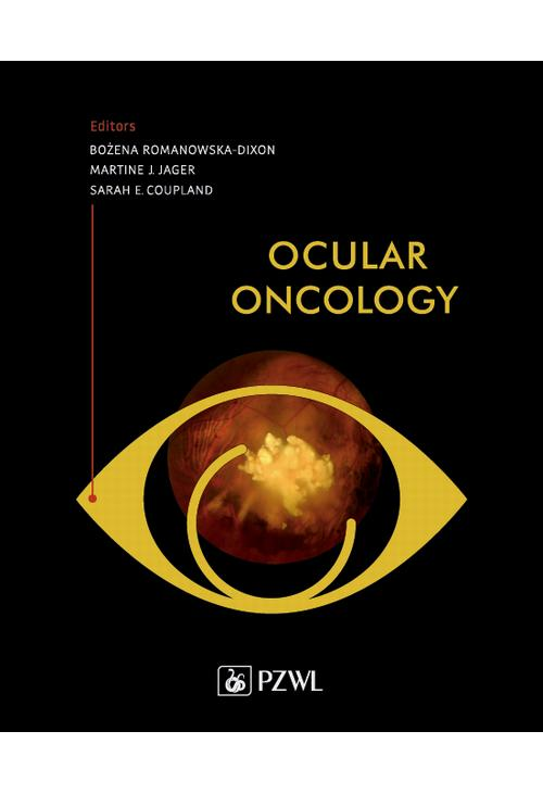 Ocular Oncology