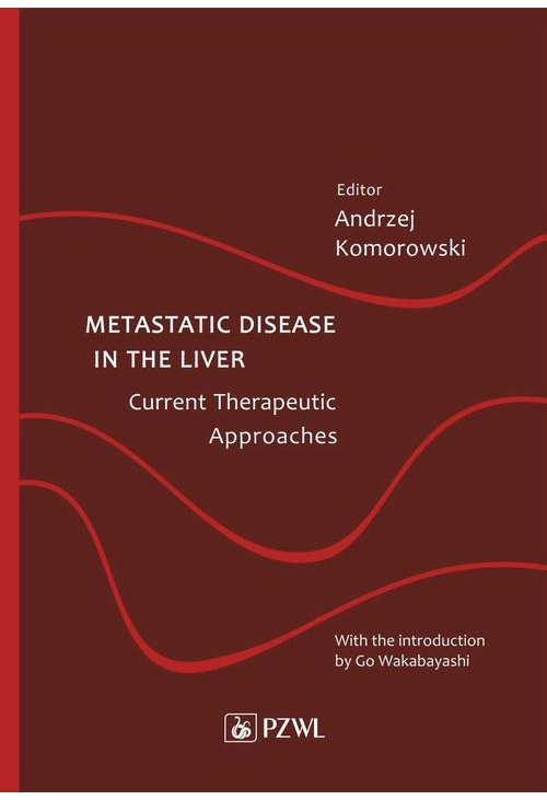 Metastatic Disease in the Liver - Current Therapeutic Approaches