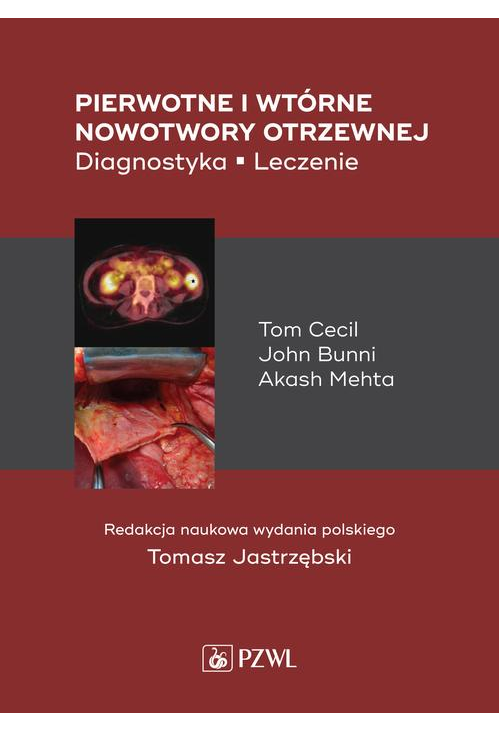 Pierwotne i wtórne nowotwory otrzewnej