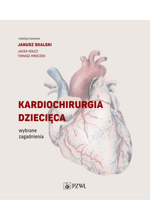 Kardiochirurgia dziecięca