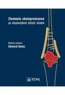 Złamania okołoprotezowe po...
