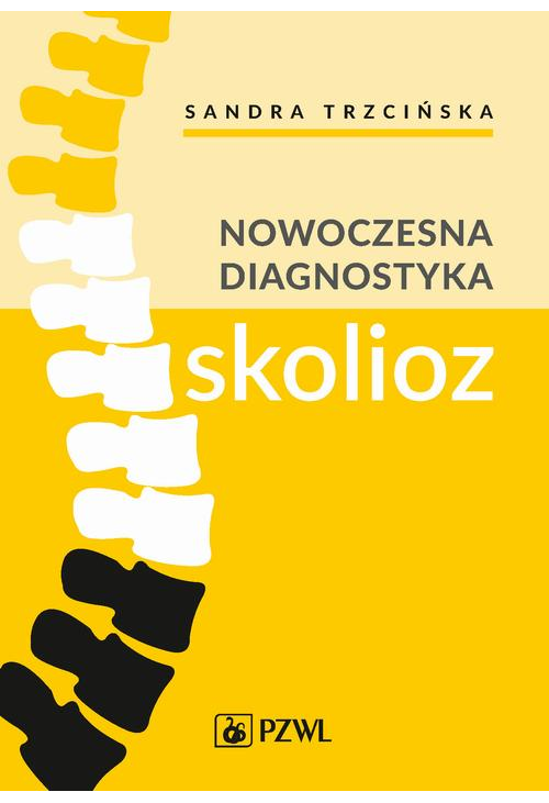 Nowoczesna diagnostyka skolioz