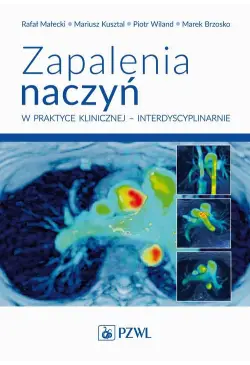 Zapalenia naczyń w praktyce...