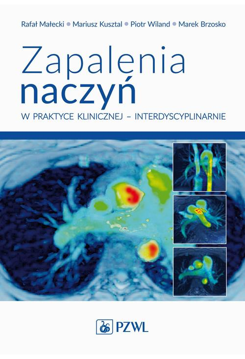 Zapalenia naczyń w praktyce klinicznej interdyscyplinarnie