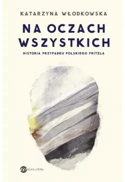 Na oczach wszystkich