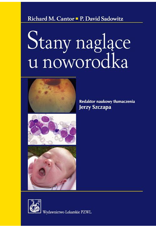 Stany naglące u noworodka