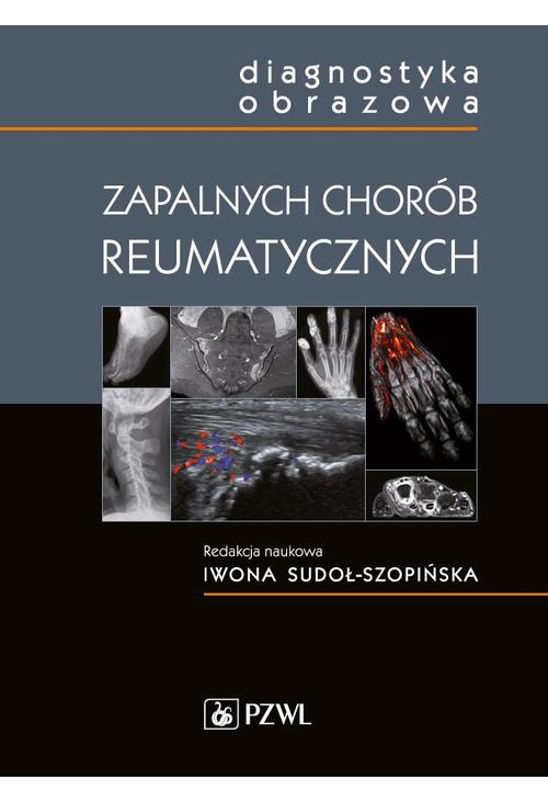 Diagnostyka obrazowa zapalnych chorób reumatycznych