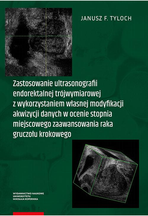 Zastosowanie ultrasonografii endorektalnej trójwymiarowej z wykorzystaniem własnej modyfikacji akwizycji danych w ocenie sto...