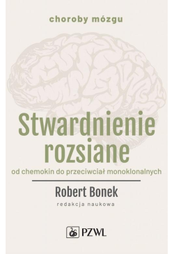 Stwardnienie rozsiane