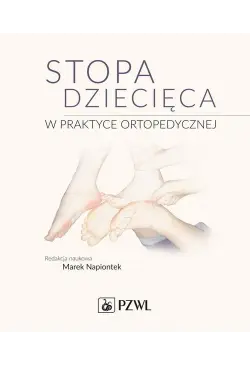 Stopa dziecięca w praktyce...
