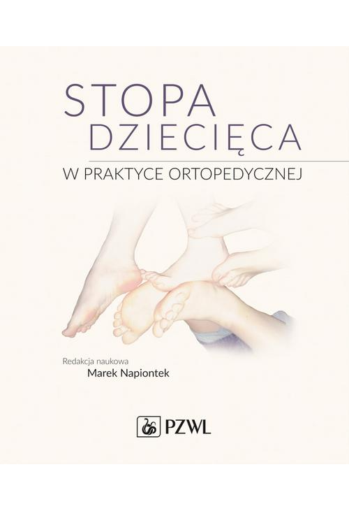 Stopa dziecięca w praktyce ortopedycznej