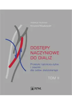 Dostępy naczyniowe do...