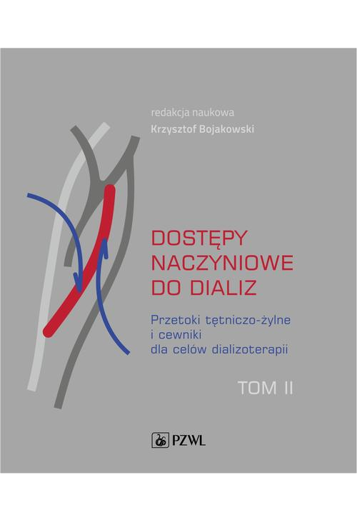 Dostępy naczyniowe do dializ. Tom 2