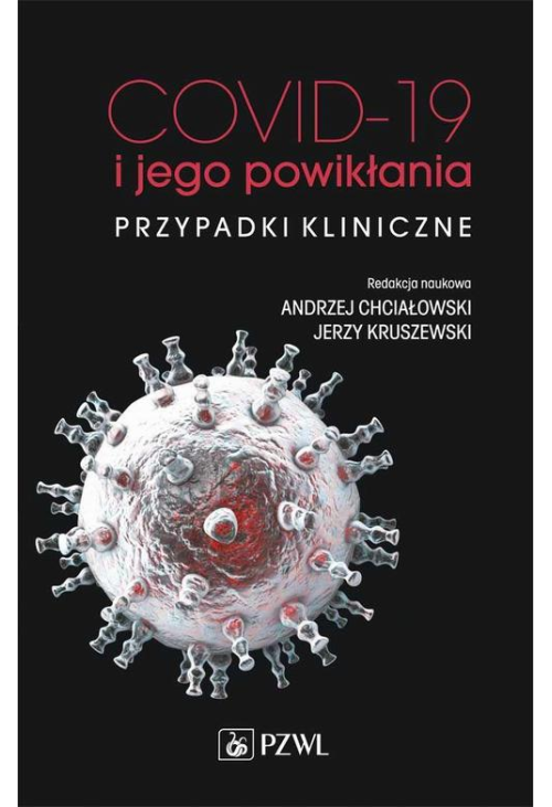 COVID-19 i jego powikłania - przypadki kliniczne